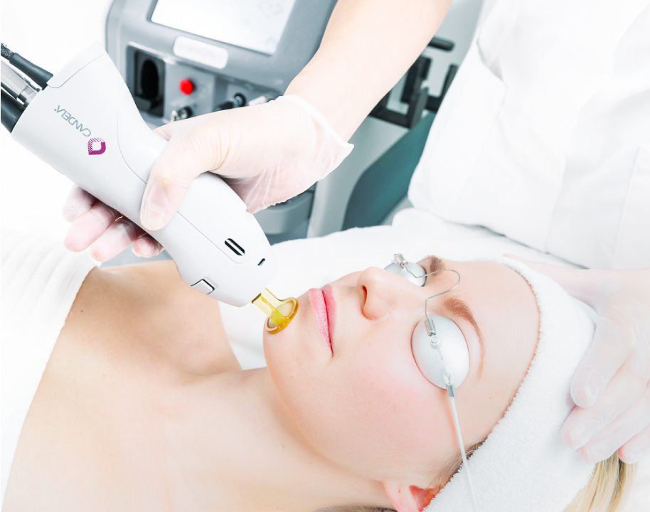 Candela Lasertherapie