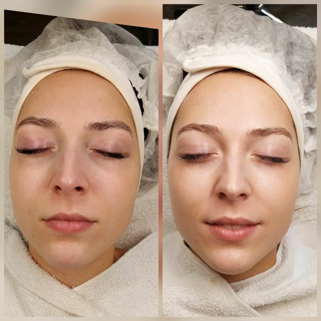 Pigmentbehandlungen mit Pikosekunden-Laser | Praxis Safar Abilov Warendorf