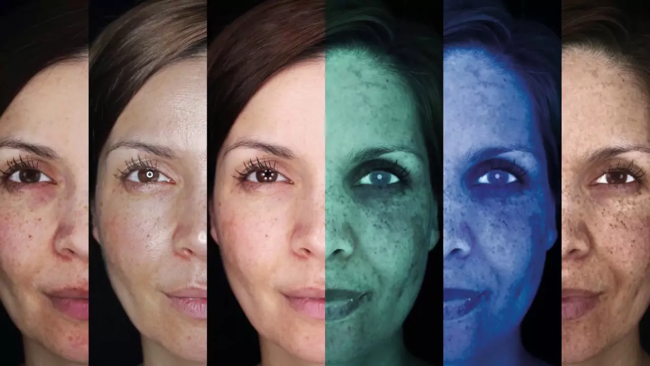 OBSERV 520x Multispektrale Hautanalyse Lichtmodi in Warendorf